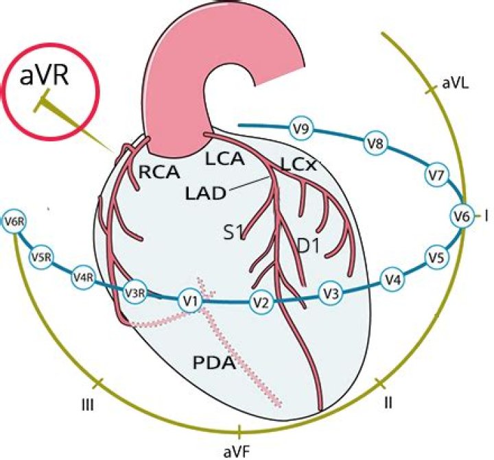 Should AVR be turned off?